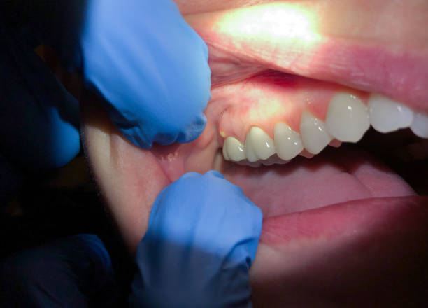 Best Urgent Tooth Repair  in Rancho Alegre, TX